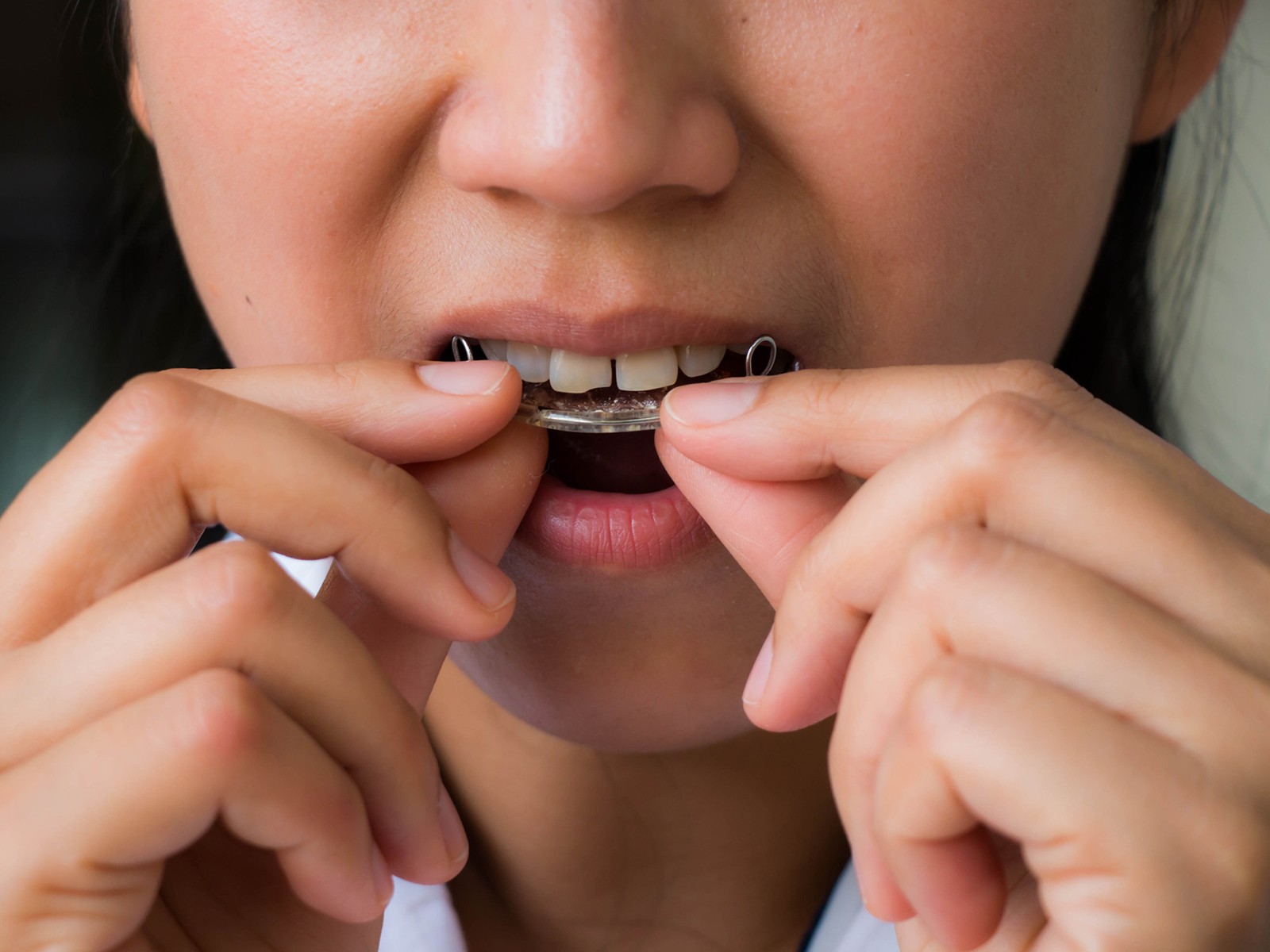 Should I brush my retainer with toothpaste?