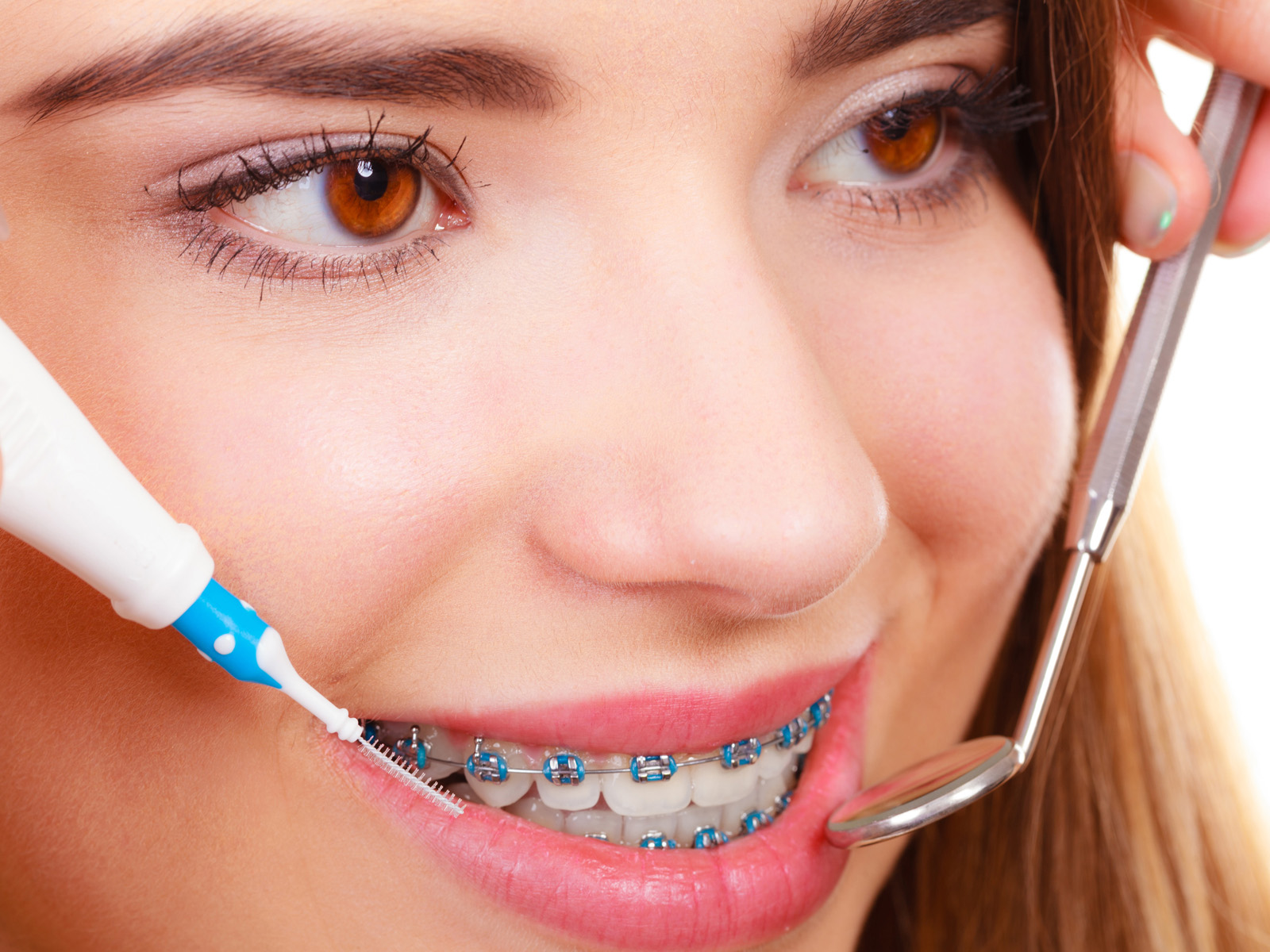 How to deal with cavities while wearing braces