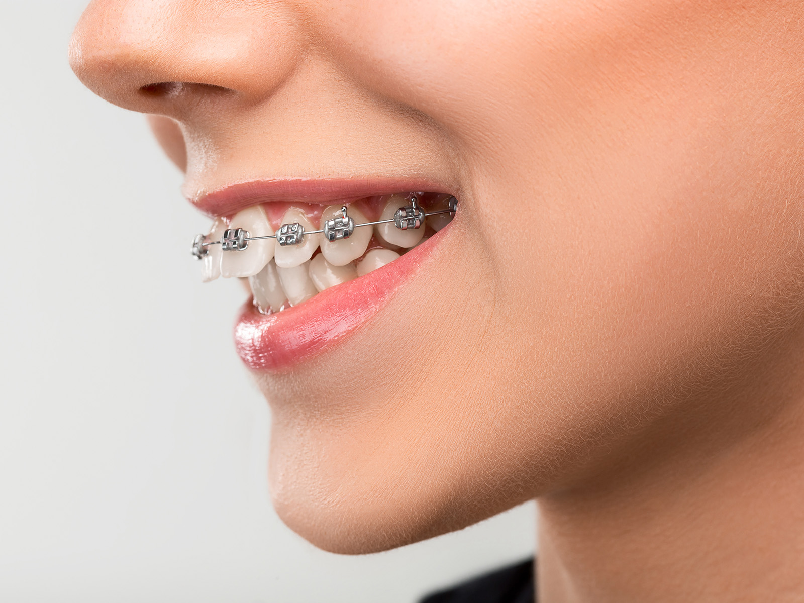 What Is The Best Age To Begin Orthodontic Treatment?