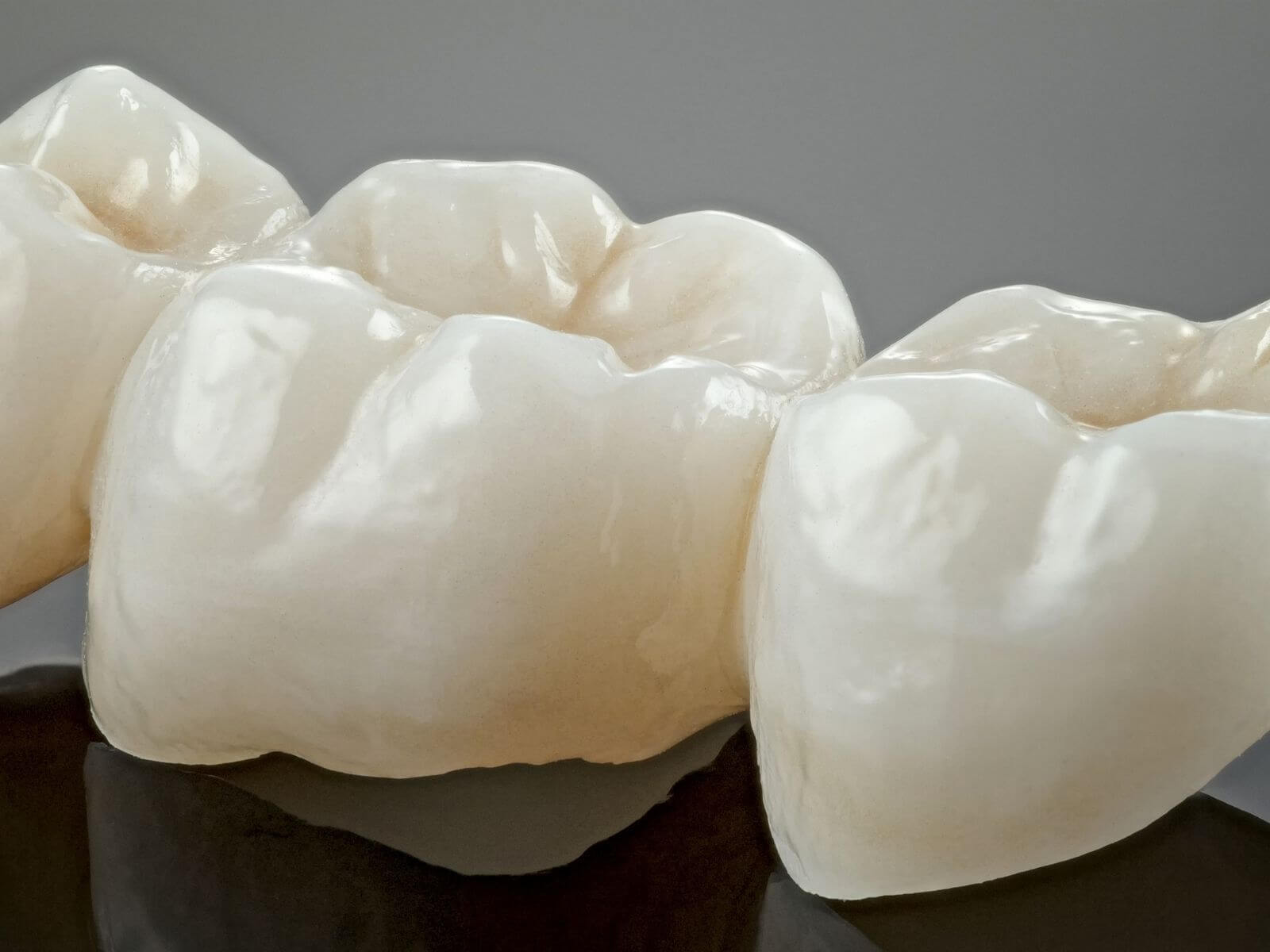7 Downsides of Dental Crowns Your Dentist Might Not Mention