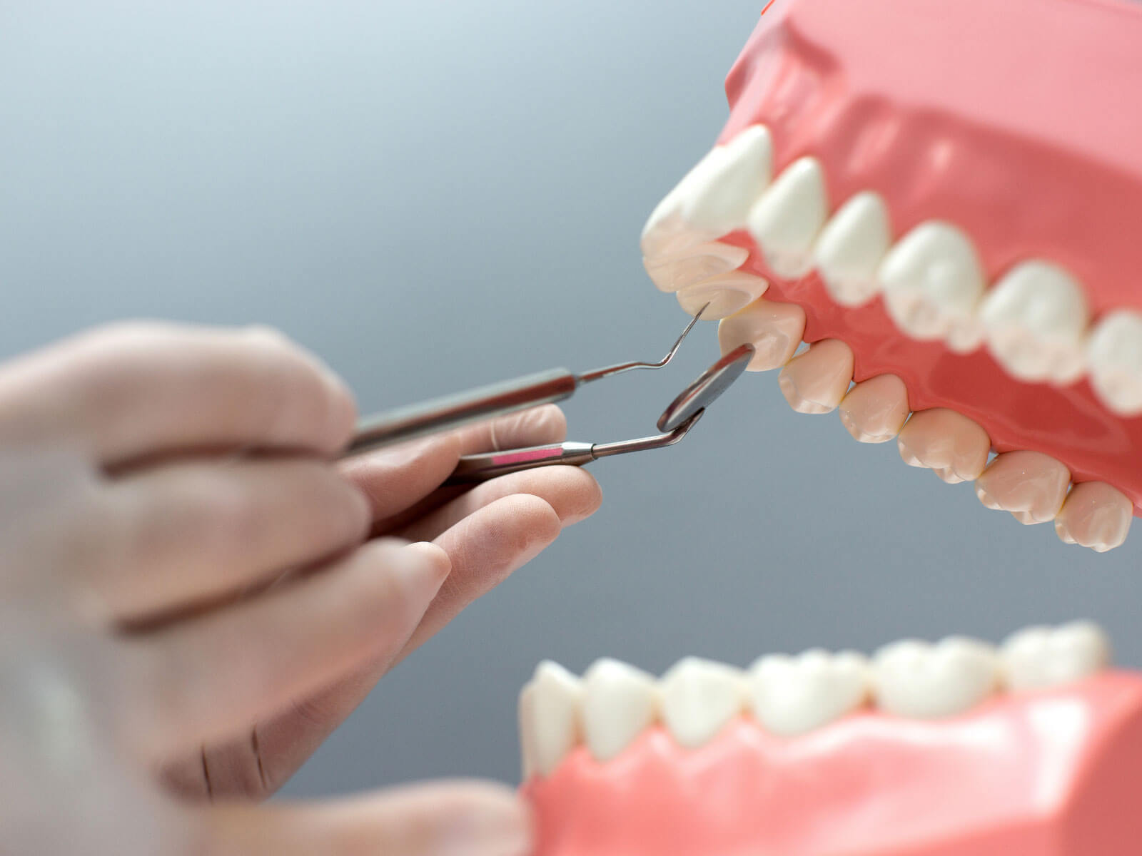 Dental Implants vs. Dental Bridges: Pros, Cons, Cost, and Which Is Right for You